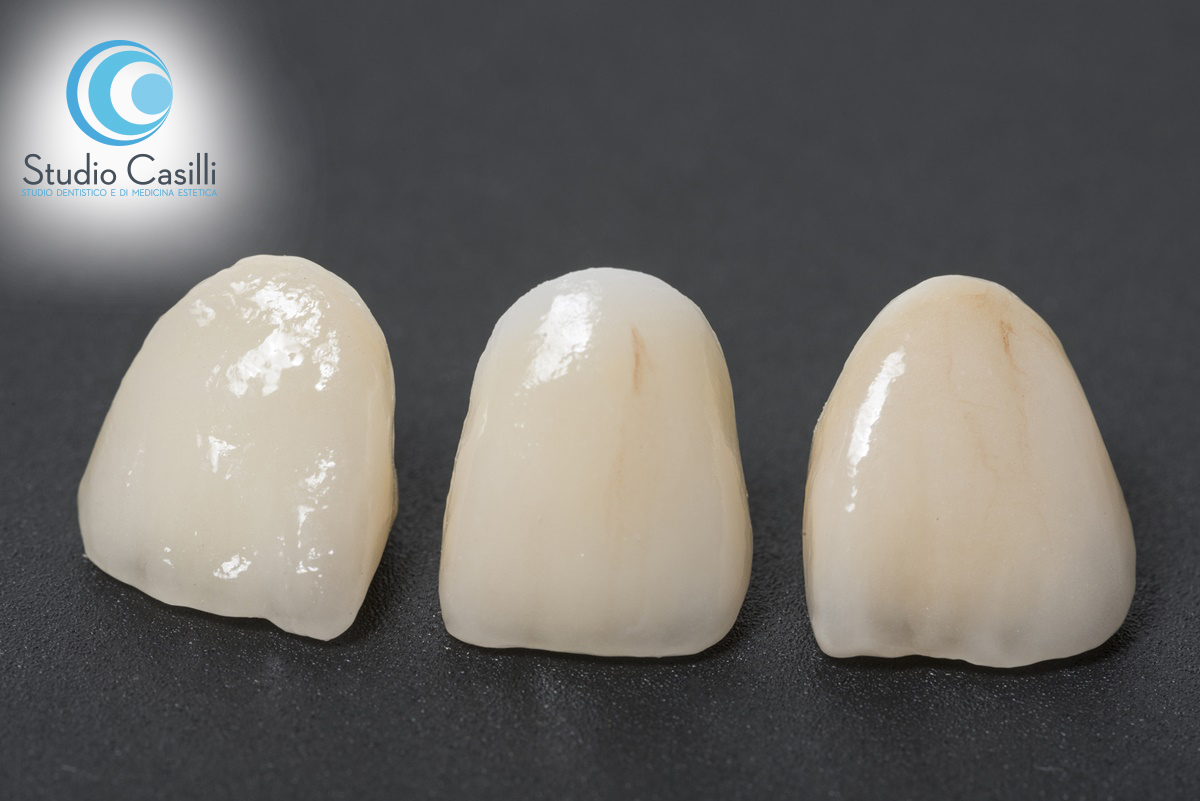 Sbiancamento ed estetica dentale Sbiancamento ed estetica dentale