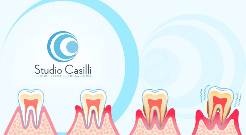 paradontologia-messina