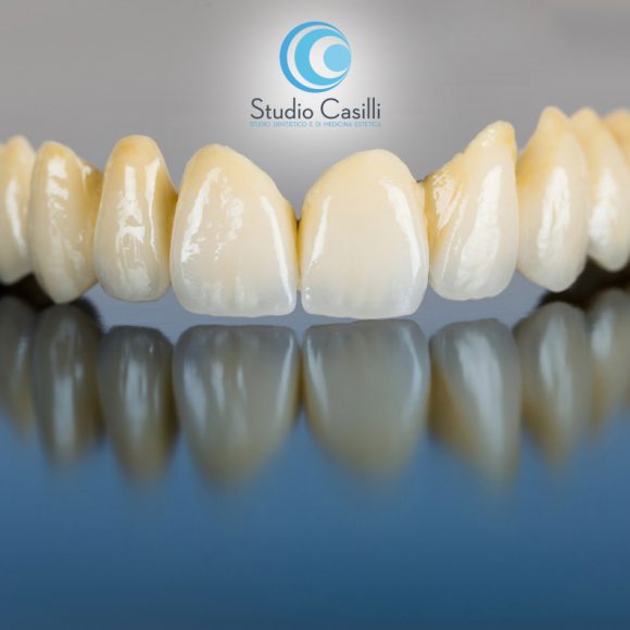 protesi-dentale-messina